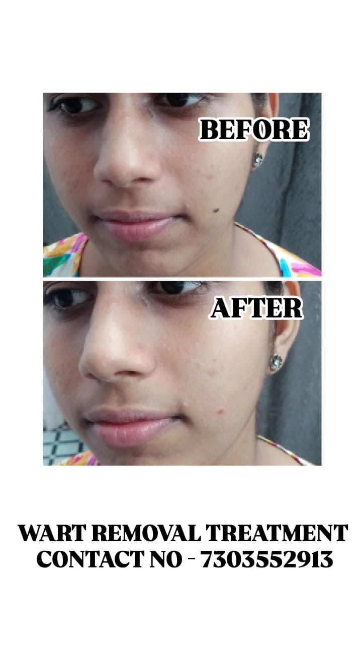 Patient Testimonial