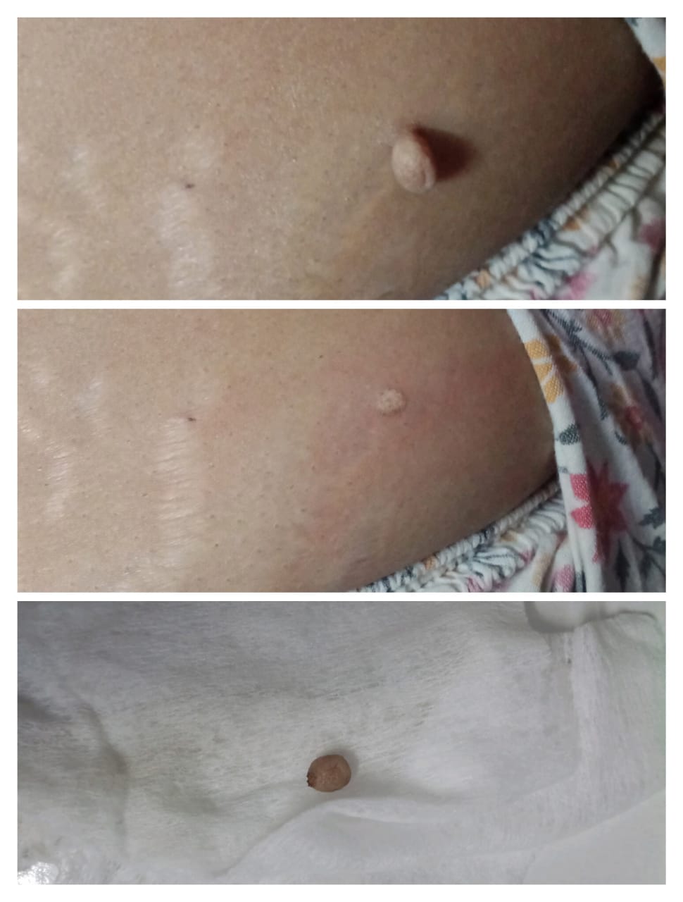 Patient Testimonial